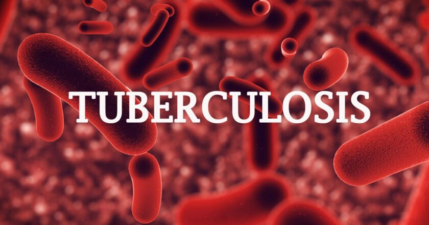 More than 2,000 tuberculosis cases identified in the first half of 2023 in Plateau – NTBLCP