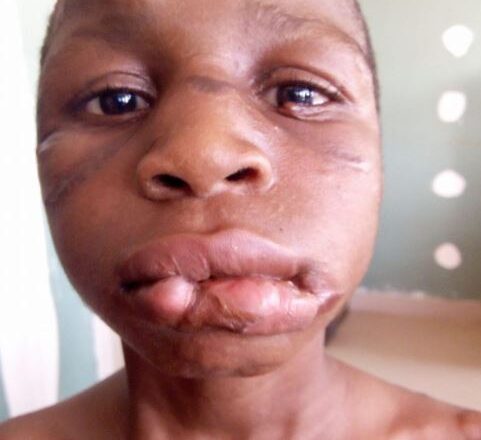 12-Year-Old Maid’s Reproductive System Damaged After Being Tortured By Her Madam [Photos]