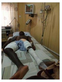 Endless Joy, As Nigerian Man, Whose Leg Has Been Permanently Up, Finally Undergoes A Surgery [Photos]
