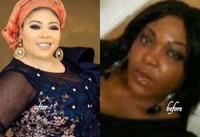 I Identity of the Lady behind Viral Skin Bleaching Procedure Revealed [Video]