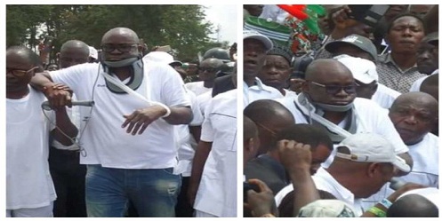 More Photos of “Injured” Governor Fayose Addressing People With Neck Collar [Photos]