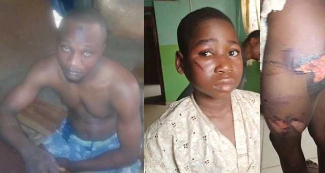 Alfa Arrested for Brutalizing 10-Year-Old Boy with Hot Pressing Iron