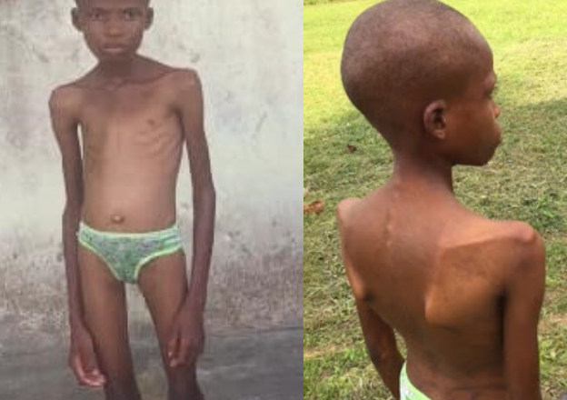 13-year-old girl allegedly locked up in toilet, tortured, starved by her mother for years in Akwa Ibom after prophet claimed she was possessed by demon (photos)