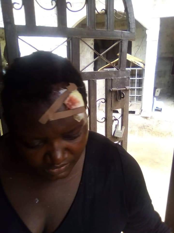 Nigerian man flees after breaking his wife's head with pestle