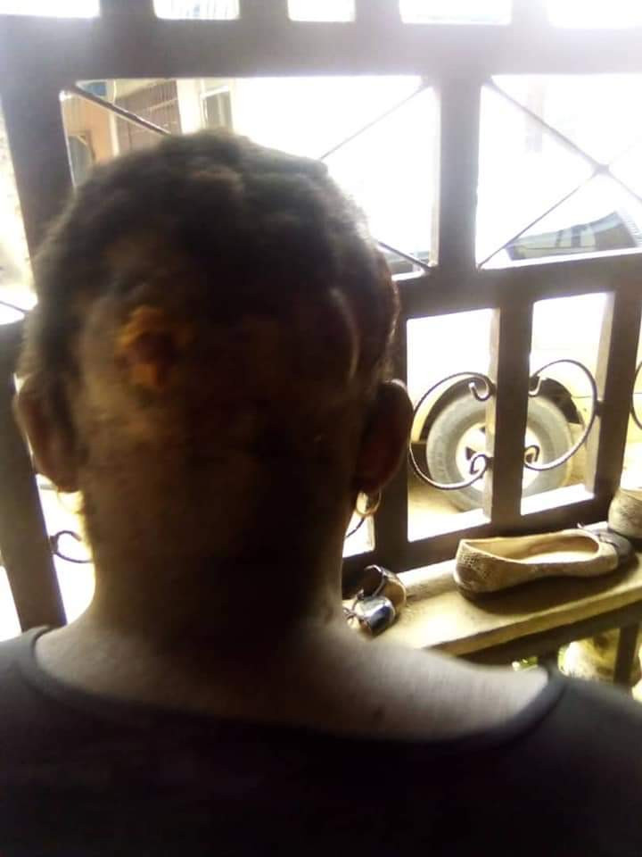 Nigerian man flees after breaking his wife's head with pestle