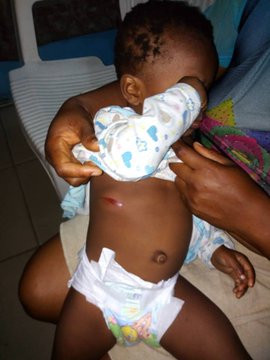 Baby nearly killed by stray bullet allegedly fired by police officer in Port Harcourt (photos)