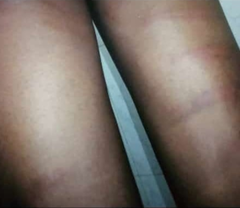Nigerian Student says he was flogged by teachers for identifying as a Marlian (photos)