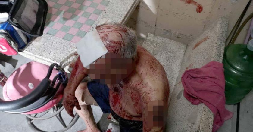 78-year-old pensioner involved in a knife fight with his wife, found soaked in blood (photos)