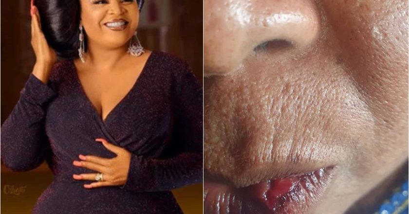 Landlord Accused of Assaulting Actress Bimbo Afolayan’s Mother Over Security Fee, Actress Cries Out