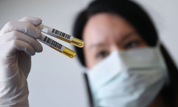 China Approves Two Coronavirus Vaccines for Human Trials