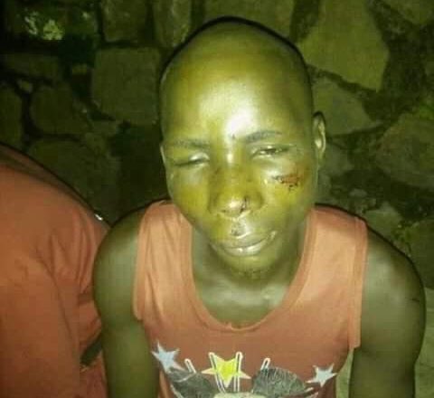 Survivor shares harrowing ordeal of being targeted by cultists in Ebonyi