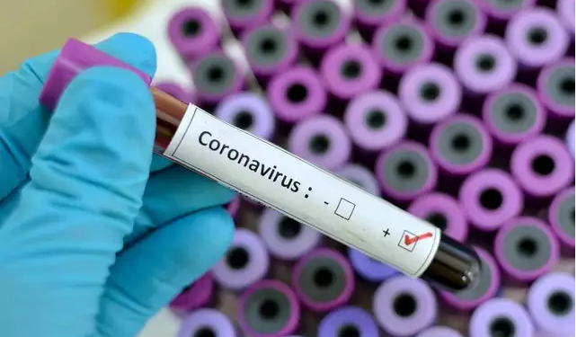 Doctor dies in Akwa Ibom with symptoms of Coronavirus