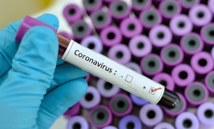 Second Case of Coronavirus Confirmed in Ebonyi State