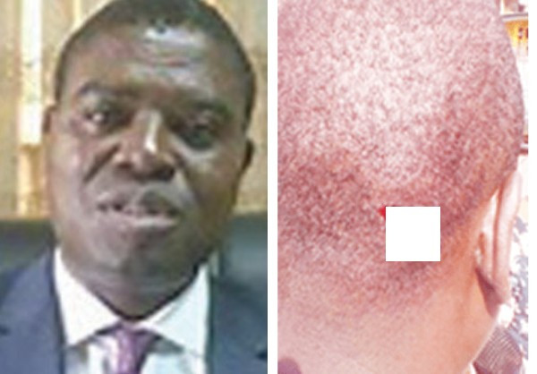 Graphic Photo: Former Edo Commissioner for Justice Targeted by Gunmen