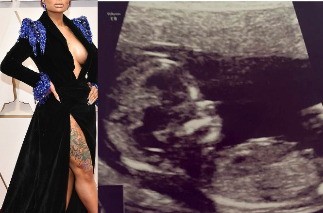 Blac Chyna’s Potential Pregnancy: A Hint or a Joke?