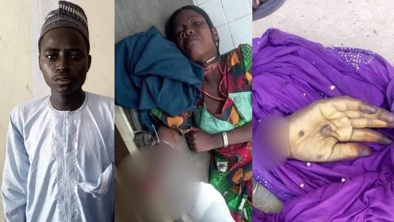 Man, 22, arrested for cutting off wife's hand in Yobe (graphic photos)
