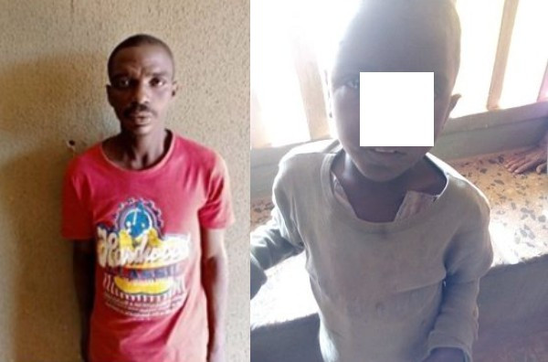 Alleged father apprehended for allegedly causing burns to his 5-year-old son