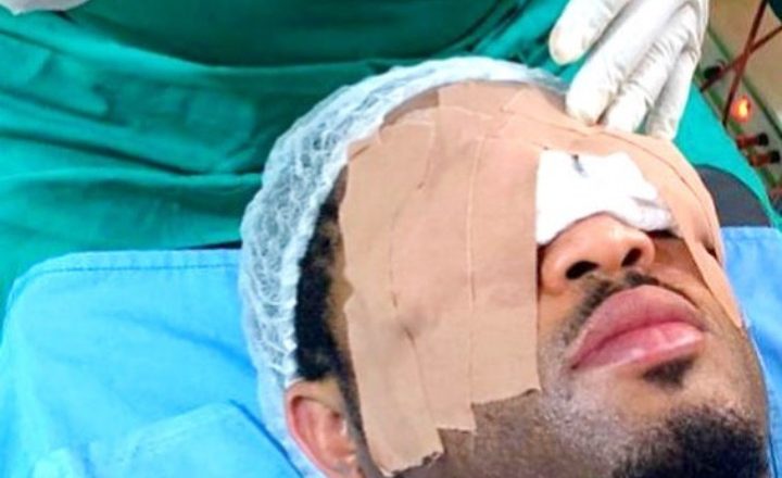 Mike Ezuruonye’s Eye Surgery due to Harsh Movie Production Lights
