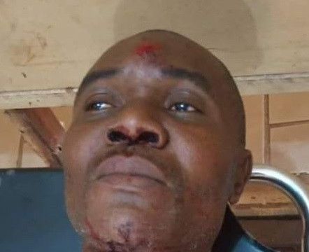 Man in Abuja Stabbed in the Neck by Motorcycle Thieves (Graphic Image)