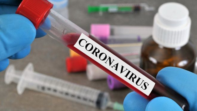 Insights from NCDC About Coronavirus Testing in Nigeria