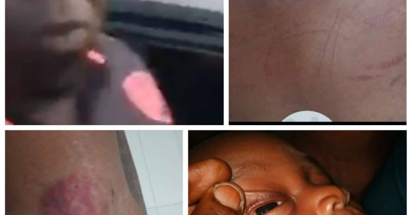 Tony Ojukwu, head of NHRC, calls for justice for woman and her three-month-old baby allegedly assaulted by SARS officer in Ibadan (photos/Video)