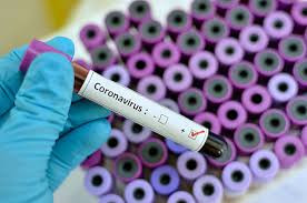 Nigerian Citizen Flees After Testing Positive for COVID-19 in Ghana
