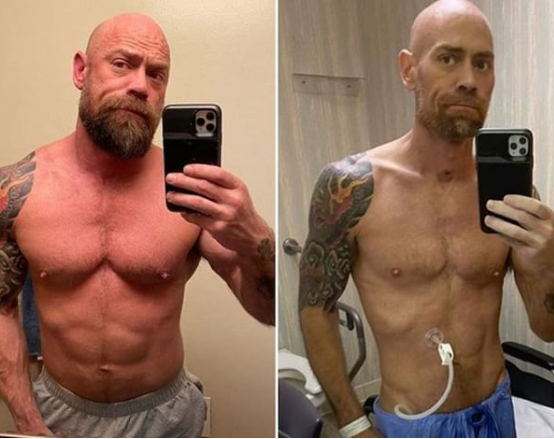 Nurse Mike Schultz’ Transformation: A Reflection of the Ravaging Effects of Coronavirus on the Body