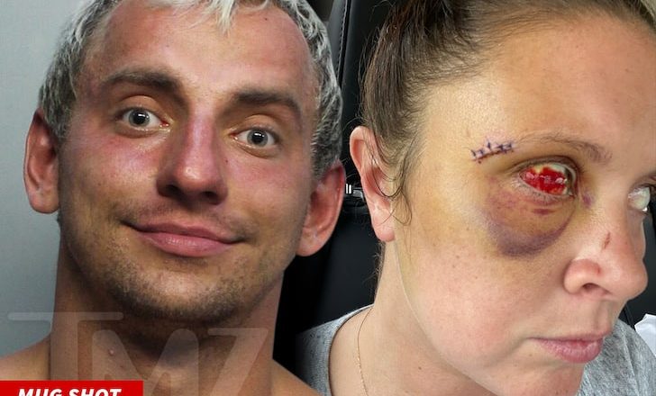 Alleged Brutal Injuries Caused by YouTuber Vitaly Zdorovetskiy to Woman