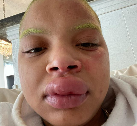 <div class="my_div">
  Slick Woods shares her experience of suffering another seizure while battling stage 3 cancer