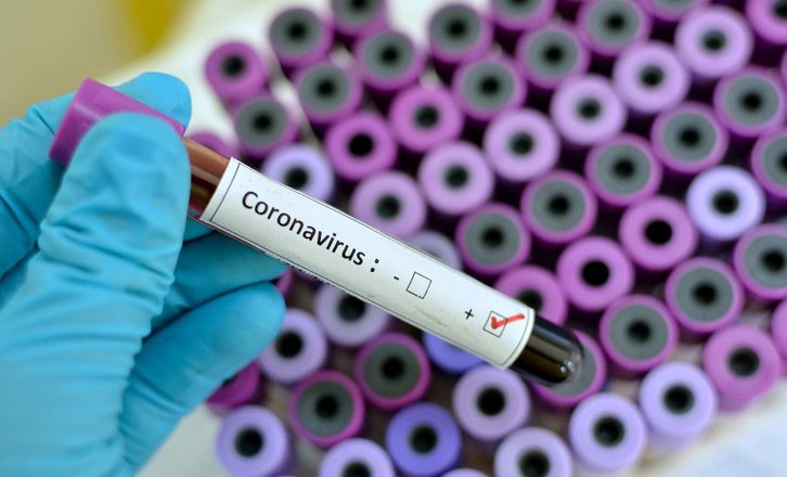 UK returnee living with our staff since Saturday is Nigeria’s third coronavirus case, says Bird View Communications President