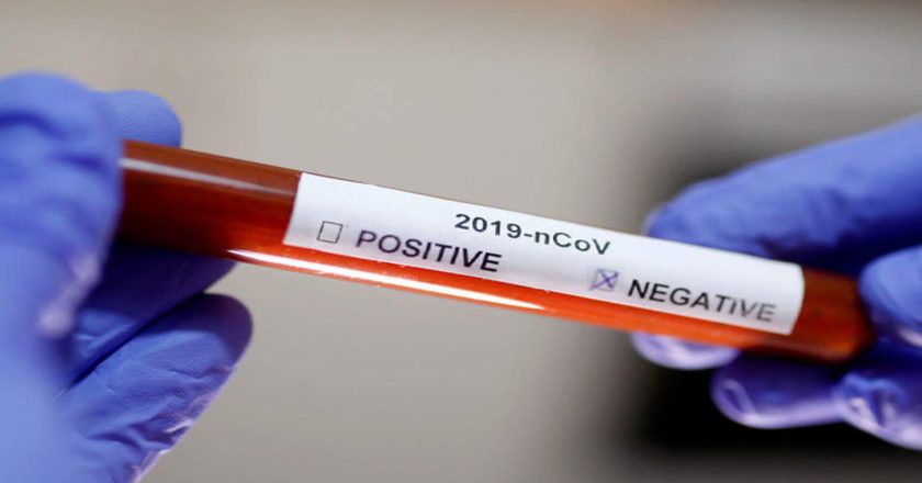 Update: Negative Test Result for Family Member of UK Returnee, the Third Coronavirus Case in Nigeria