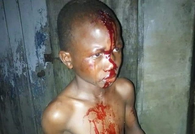 Alleged Assault by Mother Leaves Little Boy Drenched in Blood in Lagos (See Photos)