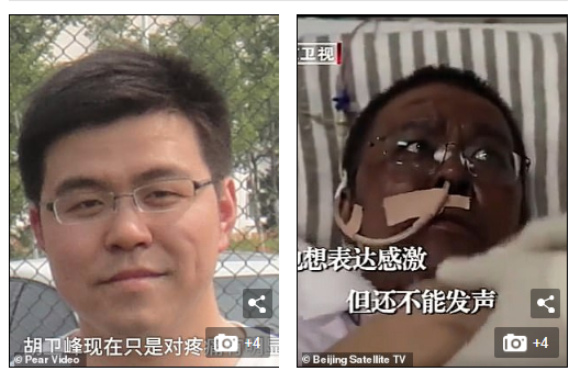 Chinese Doctors Wake Up with Darkened Skin After COVID-19 Liver Damage (See Photos)