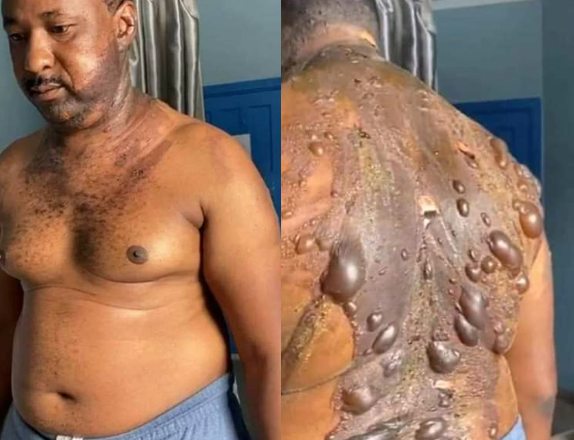 Viral Images of a Man Allegedly Attacked by His Wife for Having an Affair (Photos/Video)