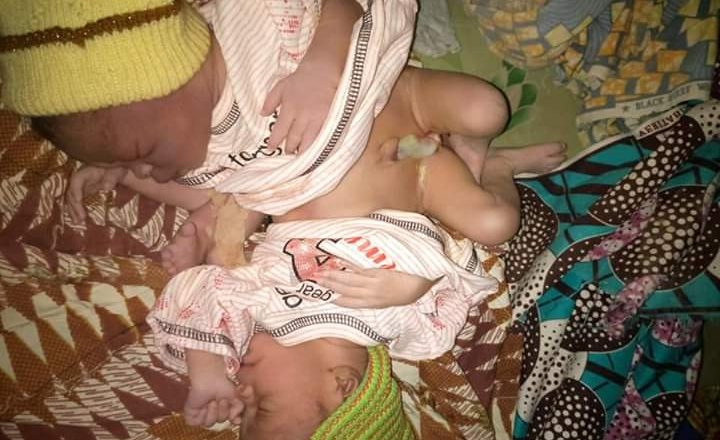 <!DOCTYPE html>
<html>
<body>

Woman gives birth to conjoined twins in Kaduna
