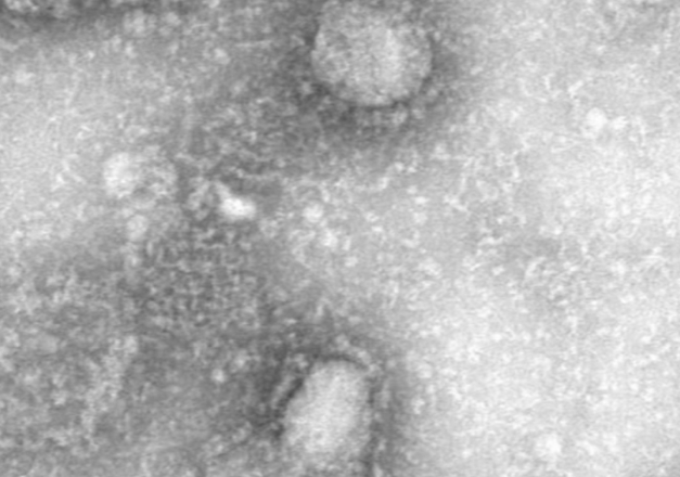 Second Confirmed Case of Coronavirus Found in Chicago Woman
