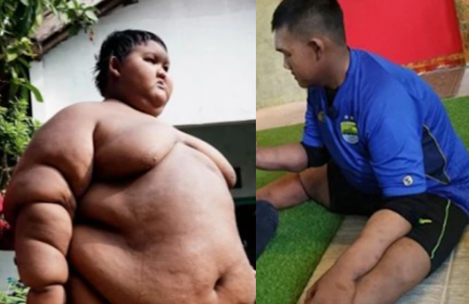 Impressive Body Transformation: World’s Fattest Boy’s 30-Stone Weight Loss Journey (With Photos)