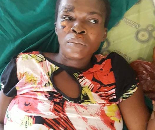 Appeal for Information Regarding Woman Found Unconscious by the Roadside in Anambra