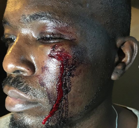 Unprovoked Attack: Lagos Man Seeks Justice