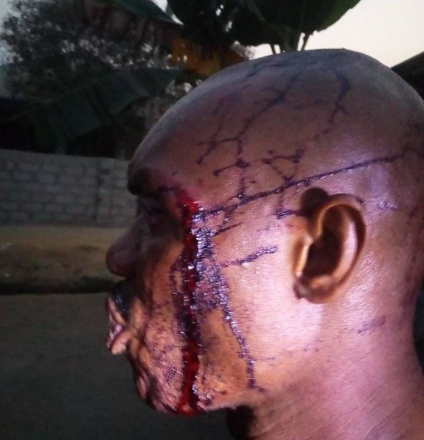 Violent Attack on Head of Vigilante in Rumuchiolu, Allegedly by Local Vigilante Group OSPAC (Graphic Photos)