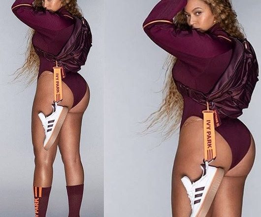 Beyonce’s New Captivating Photo Grabs Attention