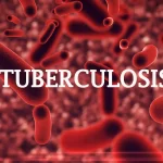 The Bauchi State Government Pledges Increased Funding for Tuberculosis Diagnosis and Treatment