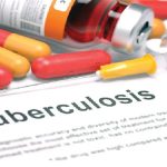 High Number of Tuberculosis Cases reported in Nasarawa State