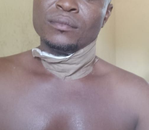 Cousin’s Throat Slashed Over Tree Branch Dispute in Ebonyi