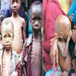 Challenges of Malnutrition in Nigeria Due to Limited Access to Healthy Diets