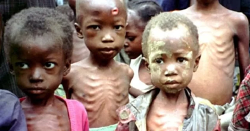 CS-SUNN Warns: Child Survival and Growth in Nigeria Under Threat Due to Malnutrition