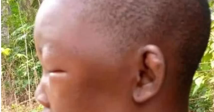 Rescue Operation by Anambra State: Abused House Girl Demoted to Primary 3 by Employer