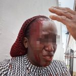 Police begin probe as husband allegedly brutalises wife in Delta